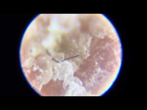 tırnak mantarı mikroskop
